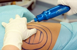 7 أضرار صحية للإفراط في تناول الدهون