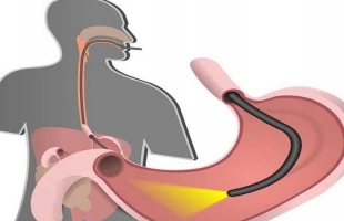 أفضل وقت لتحسين الهضم