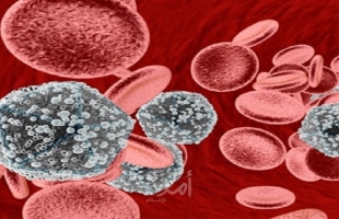 التوصل لعلاج جديد لفيروس الإيدز قريبا