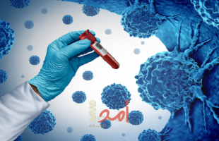 ابتكار أداة ذكاء اصطناعى تكشف كيفية نمو وانتشار الخلايا السرطانية