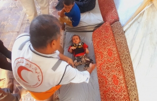 د.القدرة: لم يتم استقبال أي حالة اشتباه بشلل أطفال في مسشتفيات قطاع غزة