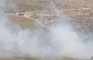 محدث -  6 إصابات إحداها حرجة برصاص مستوطنين في المغير شمال شرق رام الله