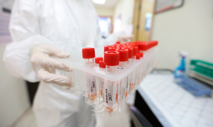 أهم 10 فحوصات صحية وقائية يجب على الجميع إجراؤها فى عام 2026