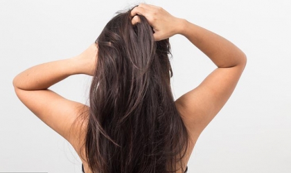 تخلصى من الحكة والإحراج بوصفات طبيعية لعلاج قشرة الرأس